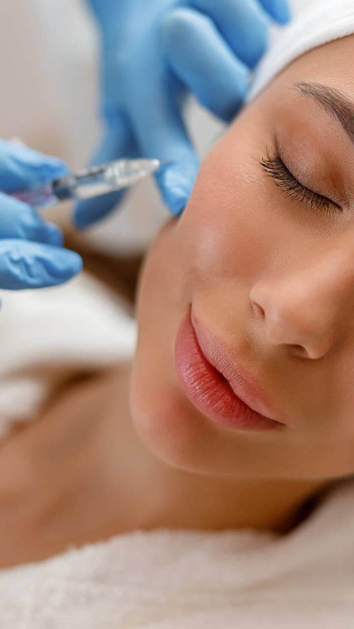 Profhilo (Skin Bio-Remodeling)